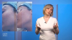 М22 | ФОТОТЕРАПИЯ | ФОТООМОЛОЖЕНИЕ | ПИГМЕНТНЫЕ ПЯТНА| СОСУДЫ