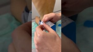 Тейпирование при сутулости