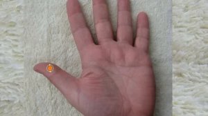 Мочеполовая система