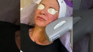 Фототерапия - эффект фотошопа