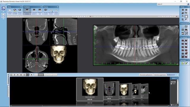 Возможности программы Romexis Viewer: работа со скриншотами смотреть онлайн