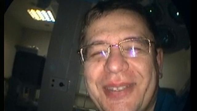Автопортрет через лапараскоп 10мм