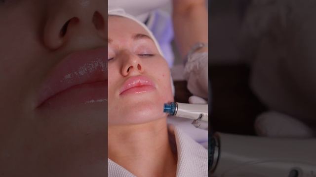 HydraFacial