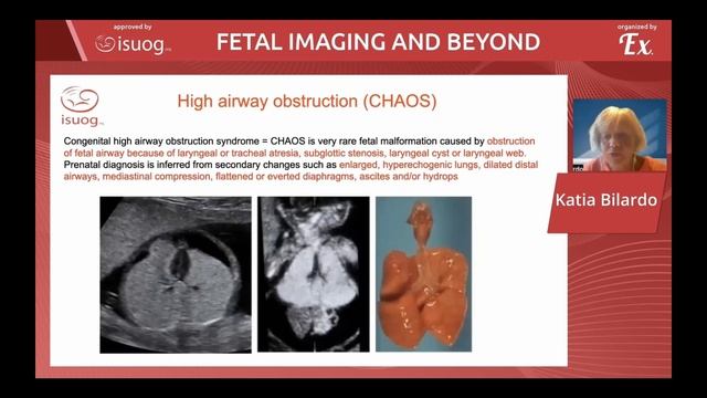 Fetal anomalies of thorax and thoracic organs смотреть онлайн