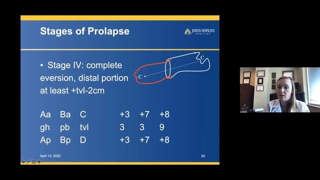 4.14.2020 Urology COViD Didactics - Pelvic Organ Prolapse: Evaluation and Management смотреть онлайн