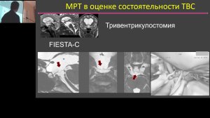 Заседание Московского общества нейрохирургов