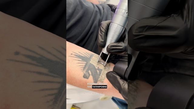 Удаление татуировки в Sokolov Laser💪🏻😎