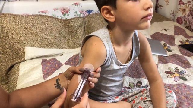 dexcom G5,Dexcom. установка декском dexcom sensors