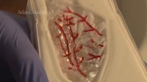 Тренажер остановки носового кровотечения