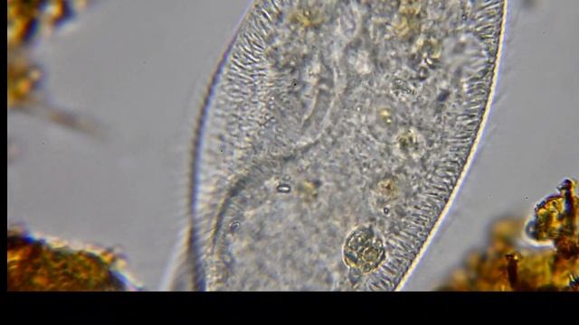 ゾウリムシの捕食にズームイン смотреть онлайн