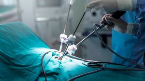 Хирурги начали делать операции по удалению опухоли в желудке методом лапароскопии в Кыргызстане