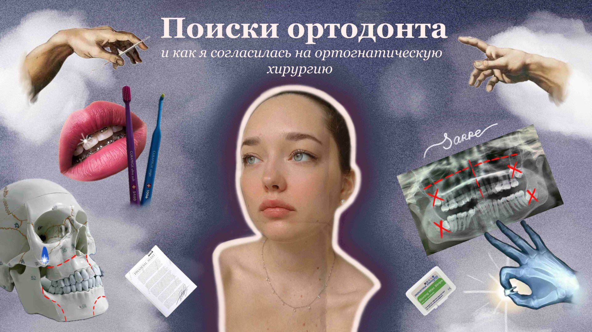 Выбор ортодонта, SARPE и ортогнатическая операция. Как все начиналось смотреть онлайн