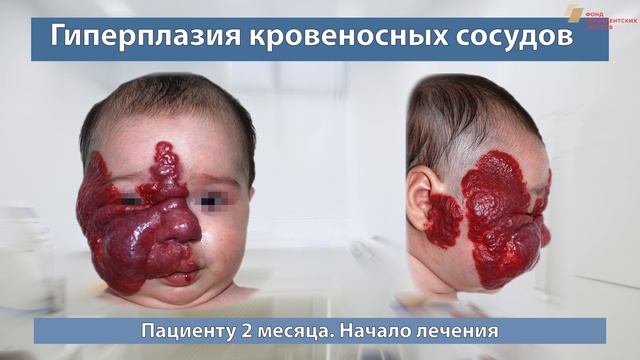 Гемангиома, прощай (Рогинский Виталий Владиславович) смотреть онлайн