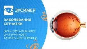 Проверьте вашу сетчатку прямо сейчас