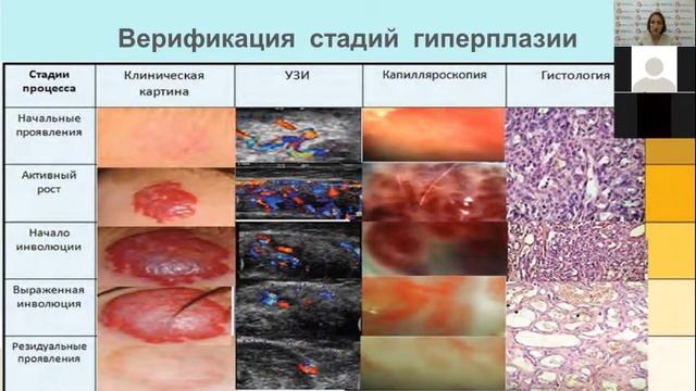 Сосудистые поражения головы и шеи у детей. Современный взгляд на диагностику и методы лечения