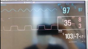 Работа с монитором пациента