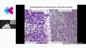 Морфология клеток костного мозга и периферической крови. Пункционная диагностика