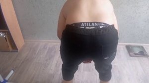 Лечение плоскостопия