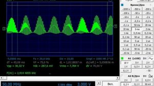 Амплипульс Микро изнутри .Режим Электрофореза.