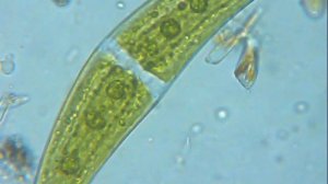 ALGA CLOSTERIUM ENTRE DIATOMS