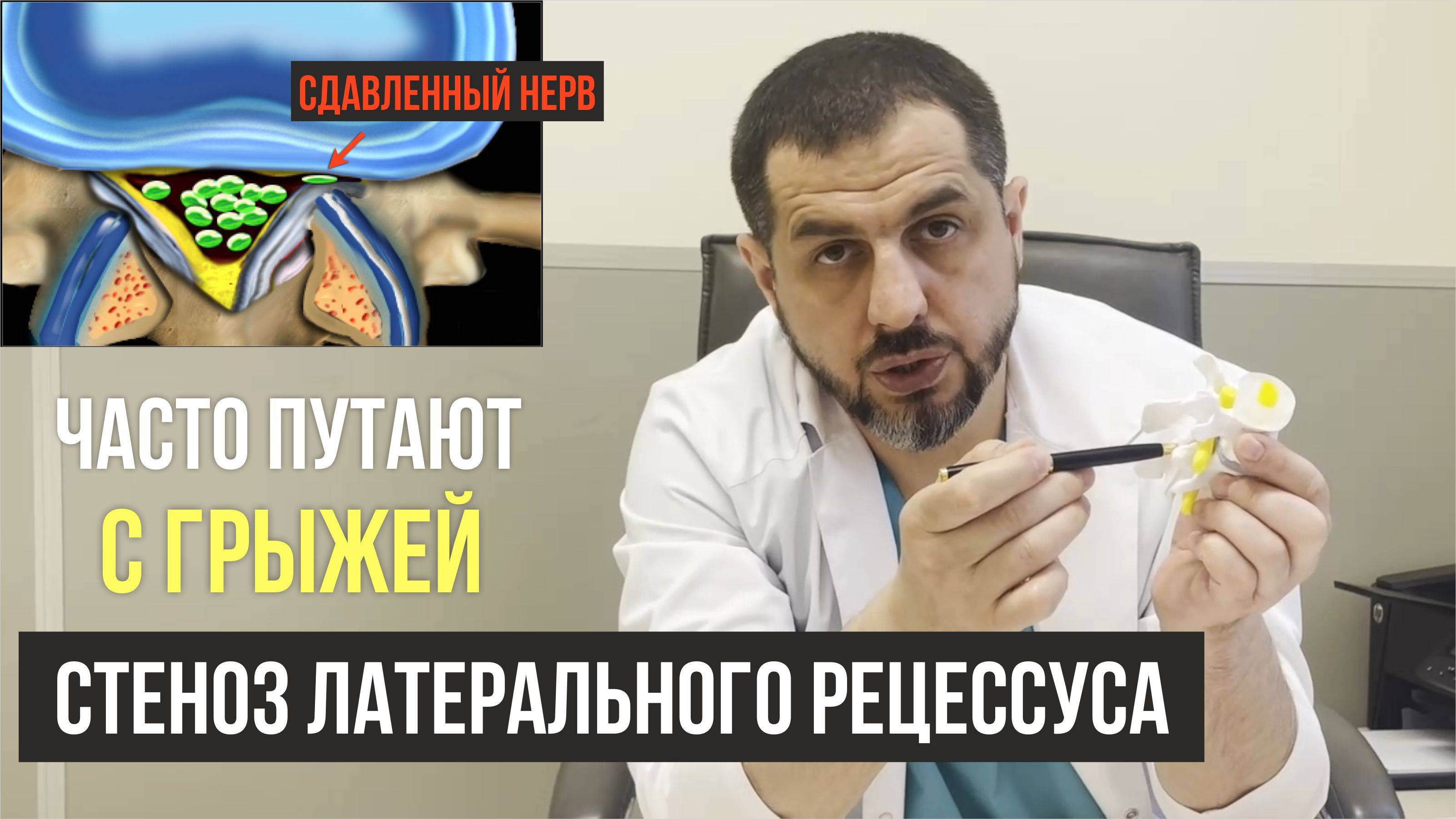 Современные эндоскопические операции при стенозах позвоночного канала