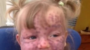 Когда ДЕВОЧКУ доставили в больницу, родители боялись, что больше не увидят свою МАЛЫШКУ..