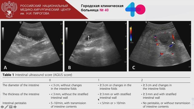 Ультразвуковой мониторинг ЖКТ у пациентов ОРИТ