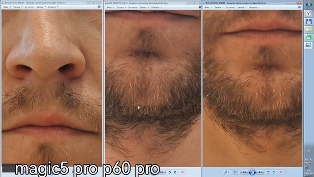 Даунгрейд за 4 года или Huawei P60 Pro vs Honor Magic5 Pro vs V30 PRO по Фоточасти-Макро,портрет,зум