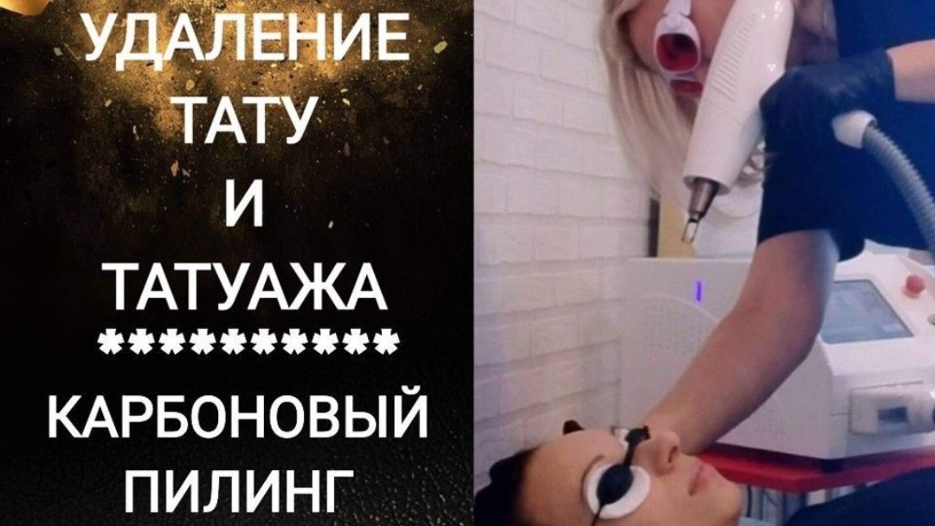 Лазерное удаление тату и татуажа 🔥Карбоновый пилинг 💫Ноябрьск 💎#permanent_Irina_f