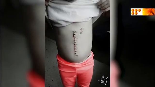 История с порезанной девочкой