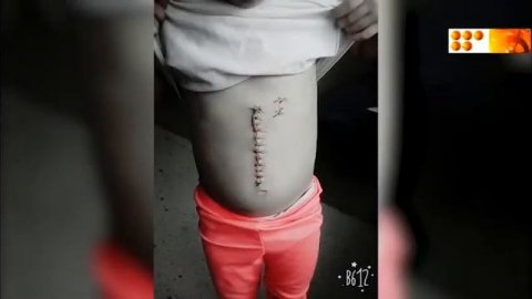 История с порезанной девочкой
