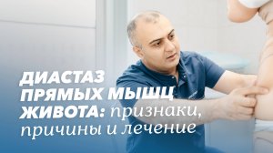 Диастаз прямых мышц живота: профилактика и лечение