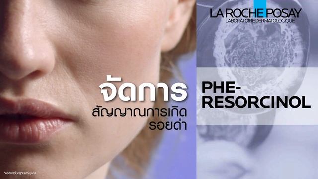 ใหม่! La Roche-Posay Pure Niacinamide 10 Serum ลดเลือนพร้อมป้องกันรอยดำจากสิว смотреть онлайн