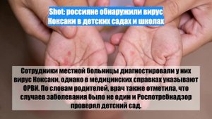 Shot: россияне обнаружили вирус Коксаки в детских садах и школах
