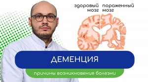 😐 Деменция. Причины возникновения болезни ❓ - тему раскрывает врач Ивери Кизицкий