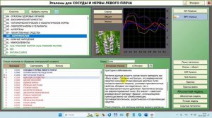 2024-07-24_132144-ПО Дианел®-2.1, окно Эталоны, группа Фитотерапия, подбор из электронного селектора
