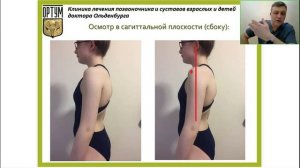 Влияние врождённой дисплазии соединительной ткани на рост и развитие ребенка.