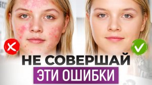 НЕОЧЕВИДНЫЕ привычки, которые ВЫЗЫВАЮТ ПРЫЩИ на лице! / Почему появляется акне и как лечить?