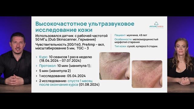 SKINHALE - революция в косметологии от АтисМед! Доказанное безынъекционное внедрение