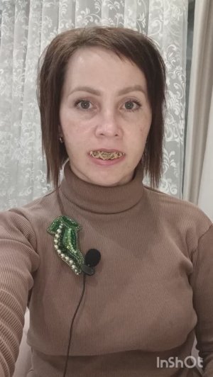 #22 Сняли сплинт. 8 недель после ортогнатии. Учусь кушать.