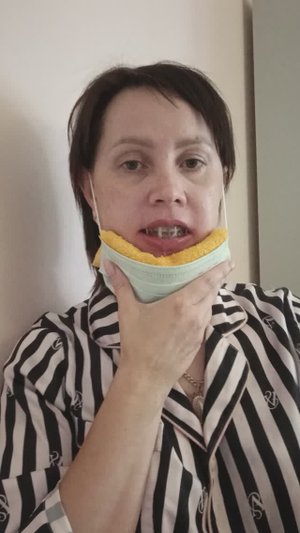 #18 Неделя после ортонатической операции. Подведение итогов за неделю