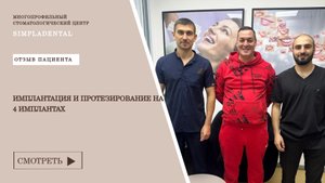 Имплантация и протезирование на 4 имплантах