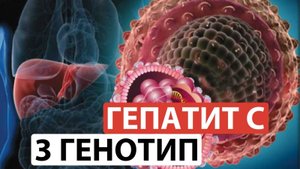 Гепатит С - 3 генотип. Этого не знает 90% врачей. Это спасет ваше здоровье и деньги!