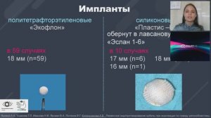 Котельникова А.В. Первичное эндопротезирование орбиты при энуклеации по поводу ретинобластомы