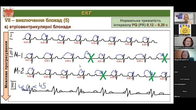 Теорія та практика: що можна побачити на кривій ЕКГ | Твій сімейний лікар