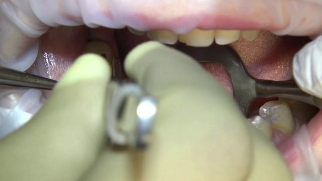 Держите, новое видео без озвучки.