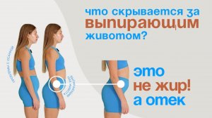 Что скрывается за выпирающим животом? Жир или отек?