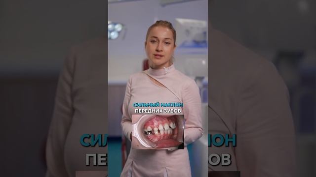 👩⚕️  Когда записывать ребенка к ортодонту?