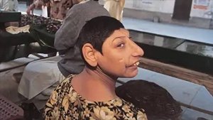 Кто такие "Крысы Шаха Даулы" в Пакистане? Это хуже, чем в Индии!