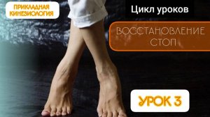 Восстановление стоп.Урок 3